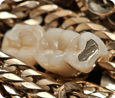 altgold-ankauf-alter-goldschmuck-analyse-2 (3).png