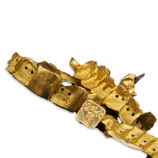 Goldankauf-Zahngold-Ankauf.png