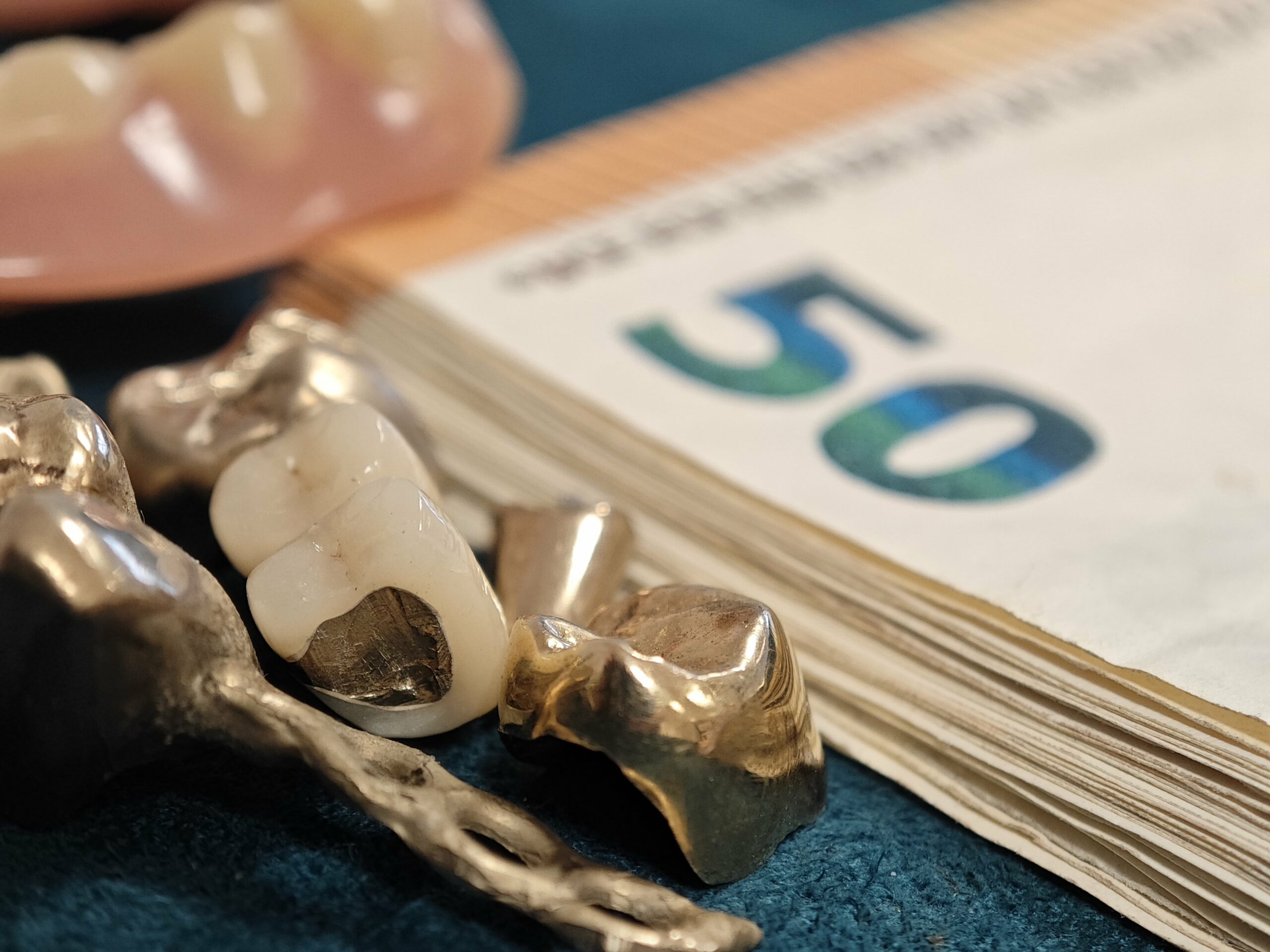 Zahngold-blog-bild-3