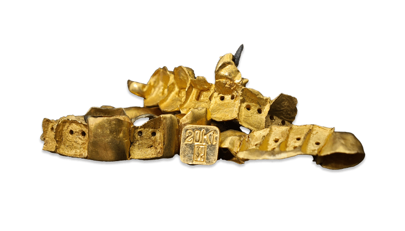 Goldankauf-Zahngold-Ankauf